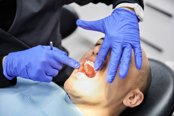 Best Urgent Care for Lost Fillings or Crowns in Suffern, NY